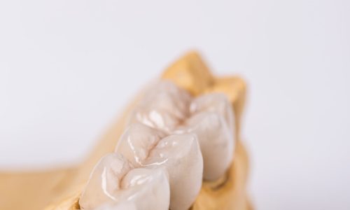 Closeup of artificial teeth on table in workshop